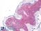 Syndecan 1 antibody, LS-B8550, Lifespan Biosciences, Immunohistochemistry paraffin image 