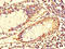 Tubulin Gamma 1 antibody, LS-C679928, Lifespan Biosciences, Immunohistochemistry paraffin image 