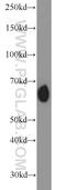 Recombination Signal Binding Protein For Immunoglobulin Kappa J Region antibody, 14613-1-AP, Proteintech Group, Western Blot image 