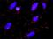 FLNA antibody, H00002316-M01, Novus Biologicals, Proximity Ligation Assay image 