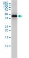 Keratin 33B antibody, H00003884-M01, Novus Biologicals, Western Blot image 