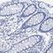 Nebulin antibody, HPA016601, Atlas Antibodies, Immunohistochemistry frozen image 