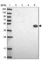 DMRT Like Family A1 antibody, NBP1-91838, Novus Biologicals, Western Blot image 