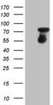 Colony Stimulating Factor 1 antibody, LS-C340010, Lifespan Biosciences, Western Blot image 