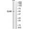 CLN5 Intracellular Trafficking Protein antibody, A04893, Boster Biological Technology, Western Blot image 