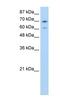 Interleukin Enhancer Binding Factor 3 antibody, NBP1-58226, Novus Biologicals, Western Blot image 