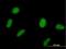 Speckle Type BTB/POZ Protein antibody, H00008405-B01P, Novus Biologicals, Immunocytochemistry image 