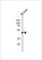 SH2 Domain Containing Adaptor Protein B antibody, LS-C158257, Lifespan Biosciences, Western Blot image 