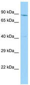 NAD Synthetase 1 antibody, TA334335, Origene, Western Blot image 