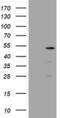 TBC1 Domain Family Member 13 antibody, MA5-26207, Invitrogen Antibodies, Western Blot image 