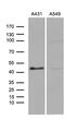 E74 Like ETS Transcription Factor 3 antibody, M01027, Boster Biological Technology, Western Blot image 