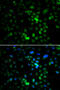 Synaptonemal Complex Central Element Protein 1 antibody, MBS129902, MyBioSource, Immunofluorescence image 