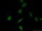 Cyclin Dependent Kinase 8 antibody, 22067-1-AP, Proteintech Group, Immunofluorescence image 