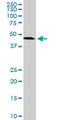 ADP-Ribosylarginine Hydrolase antibody, LS-B9939, Lifespan Biosciences, Western Blot image 