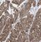 Mitochondrial Trans-2-Enoyl-CoA Reductase antibody, FNab05084, FineTest, Immunohistochemistry frozen image 
