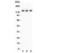 Fibulin 2 antibody, R31279, NSJ Bioreagents, Western Blot image 