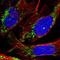 Deoxythymidylate Kinase antibody, HPA042719, Atlas Antibodies, Immunofluorescence image 