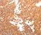 Bradykinin Receptor B2 antibody, PA5-50488, Invitrogen Antibodies, Immunohistochemistry paraffin image 