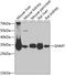 Glycine N-Methyltransferase antibody, GTX64826, GeneTex, Western Blot image 