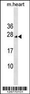 Inhibitor Of CDK, Cyclin A1 Interacting Protein 1 antibody, 59-506, ProSci, Western Blot image 