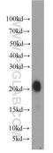Gastrokine 1 antibody, 19344-1-AP, Proteintech Group, Western Blot image 