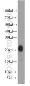 Gastrokine-1 antibody, 19344-1-AP, Proteintech Group, Western Blot image 