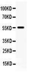 Tissue Factor Pathway Inhibitor antibody, LS-C313485, Lifespan Biosciences, Western Blot image 