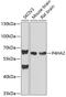 Prolyl 4-hydroxylase subunit alpha-2 antibody, GTX33379, GeneTex, Western Blot image 