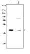 Interleukin 7 antibody, RP1013, Boster Biological Technology, Western Blot image 