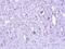 Zinc Finger CCCH-Type Containing 8 antibody, PA5-21811, Invitrogen Antibodies, Immunohistochemistry frozen image 