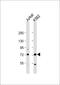 Protein Arginine Methyltransferase 5 antibody, 57-261, ProSci, Western Blot image 