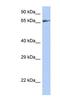 Zinc Finger Protein 676 antibody, NBP1-79342, Novus Biologicals, Western Blot image 