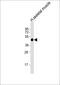 Hydroxylysine Kinase antibody, M15435, Boster Biological Technology, Western Blot image 