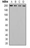 Laminin Subunit Beta 2 antibody, abx133689, Abbexa, Western Blot image 