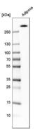 Acetyl-CoA Carboxylase Beta antibody, NBP1-90274, Novus Biologicals, Western Blot image 