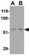 Receptor Interacting Serine/Threonine Kinase 2 antibody, GTX31647, GeneTex, Western Blot image 