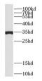 Ubiquitin-conjugating enzyme E2 R1 antibody, FNab01527, FineTest, Western Blot image 