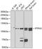 Protein Tyrosine Phosphatase Non-Receptor Type 3 antibody, GTX54572, GeneTex, Western Blot image 