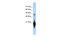 Chromosome 17 Open Reading Frame 49 antibody, 26-770, ProSci, Western Blot image 