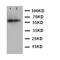Interleukin 2 Receptor Subunit Beta antibody, orb76129, Biorbyt, Western Blot image 