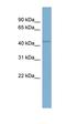 WD Repeat Containing, Antisense To TP73 antibody, orb324950, Biorbyt, Western Blot image 