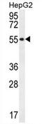 UDP-Glucuronate Decarboxylase 1 antibody, AP54498PU-N, Origene, Western Blot image 