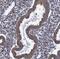 Armadillo Repeat Containing 5 antibody, NBP1-94024, Novus Biologicals, Immunohistochemistry frozen image 