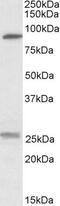 SLC4A11 antibody, PA5-19207, Invitrogen Antibodies, Western Blot image 