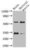 Vitronectin antibody, CSB-PA025944EA01HU, Cusabio, Western Blot image 