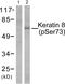 Keratin 8 antibody, PA5-38072, Invitrogen Antibodies, Western Blot image 