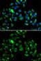 Caspase Recruitment Domain Family Member 11 antibody, GTX55548, GeneTex, Immunofluorescence image 