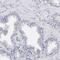 Outer dense fiber protein 2 antibody, PA5-51649, Invitrogen Antibodies, Immunohistochemistry paraffin image 