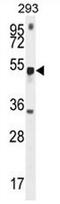 Methyltransferase Like 4 antibody, AP52676PU-N, Origene, Western Blot image 
