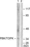 PDZ Binding Kinase antibody, LS-B8369, Lifespan Biosciences, Western Blot image 